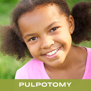 Pulpotomy in Clairemont Mesa East